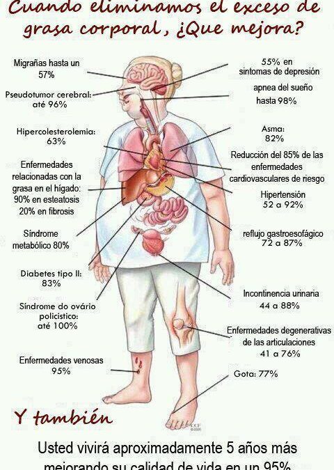 Plano de enfermedades relacionadas con la obesidad
