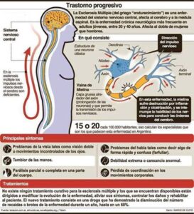 Esclerosis lo que debes saber 5 datos asombrosos