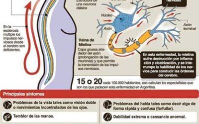 Esclerosis lo que debes saber 5 datos asombrosos