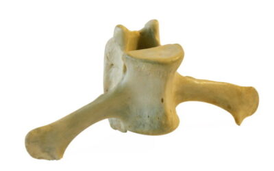 MAREOS CERVICALES