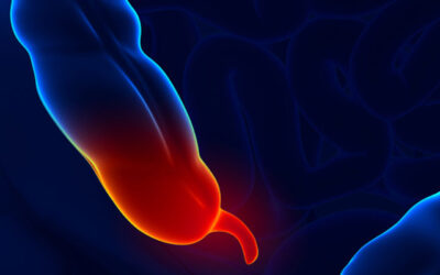 APENDICITIS: Relación emocional