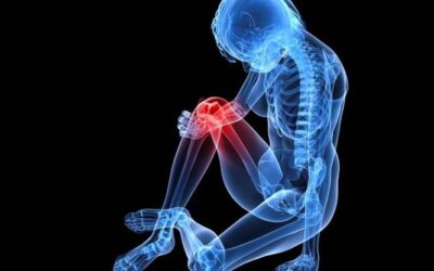 REMEDIOS ACIDO URICO