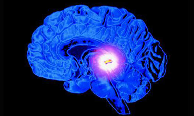 Activa tu glándula pineal con esta imagen