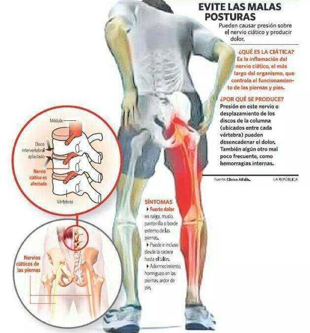 1 prodigioso ejercicio para intenso dolor ciático