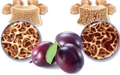 Ciruelas para tratar la osteoporosis