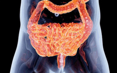 10 alimentos que eliminan a los parásitos intestinales