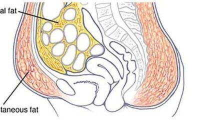 TÉCNICAS PARA PERDER GRASA ABDOMINAL