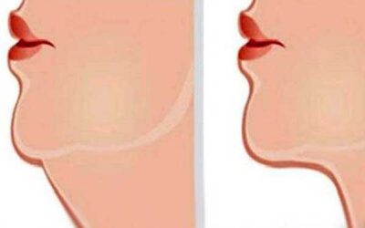 EJERCICIOS PARA REDUCIR LA PAPADA