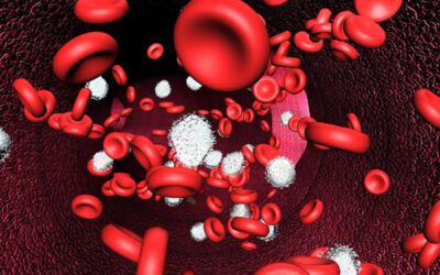 La anemia, tips que debes conocer