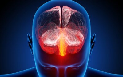 Tratamiento de choque para la migraña: Tiamina