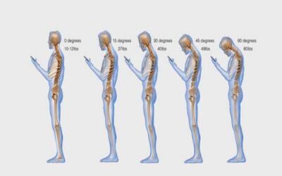 TEXT NECK