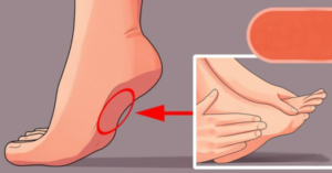 DOLOR DE PIES CRONICO