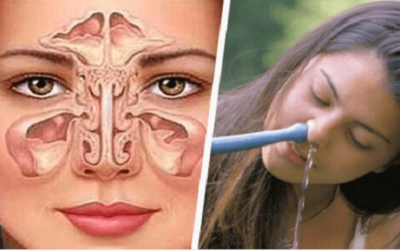 CONSEJOS PARA ALIVIAR LA SINUSITIS