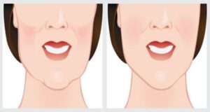 DI ADIÓS A LAS ARRUGAS CON SOLO 2 INGREDIENTES