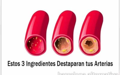 Limpia tus arterias coronarias 3 ingredientes