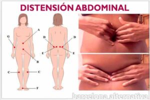 DISTENSIÓN ABDOMINAL