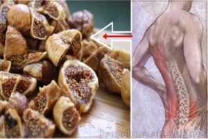 dolor de Espalda, Piernas y Columna