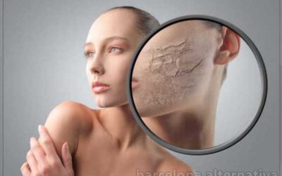 SOLUCIÓN A LA DERMATITIS Y EZCEMA