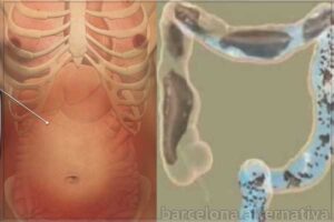 ELIMINA LOS GASES CON ESTA RECETA ANCESTRAL