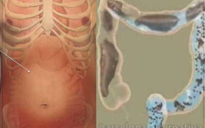 ELIMINA LOS GASES CON ESTA RECETA ANCESTRAL