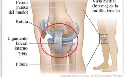 Ligamentos de las rodillas sensacional receta 100% eficaz