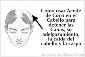 canas y calvicie