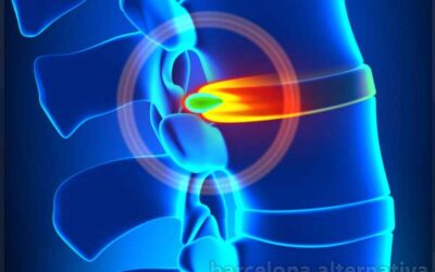 HERNIA DISCAL: TRATAMIENTO PARA EL DOLOR