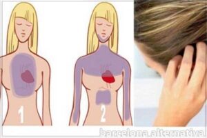 TU PELO TE AVISA DE UN POSIBLE INFARTO