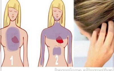 TU PELO TE AVISA DE UN POSIBLE INFARTO