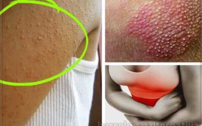 SEÑALES QUE DELATAN INTOLERANCIA AL GLUTEN