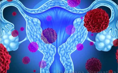 ALERTA CON EL SINDROME DE SHOCK TOXICO