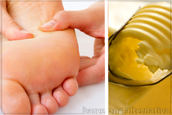 ALIVIA EL DOLOR DE PIES CON MANTEQUILLA
