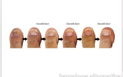 Receta rompehongos: tus pies y uñas curas