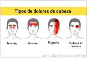 dolor de cabeza