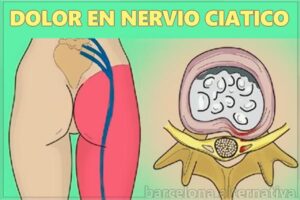 ejercicio para el dolor
