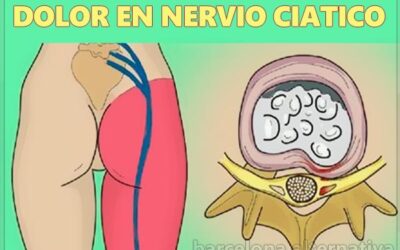 EJERCICIO PARA EL DOLOR DE CIATICA