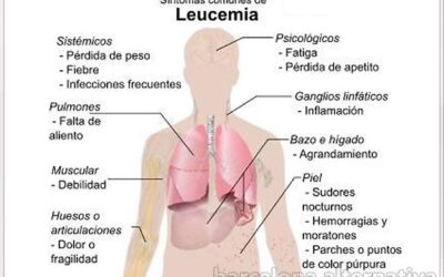 15 SÍNTOMAS DE LEUCEMIA QUE DEBES CONOCER